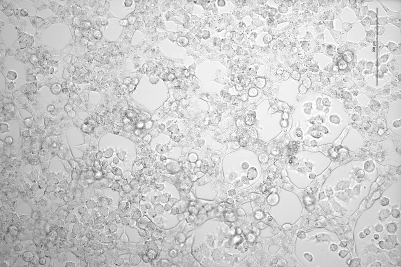 Dense culture of light gray cells under a microscope, featuring flattened and rounded shapes. A 200 µm scale bar.